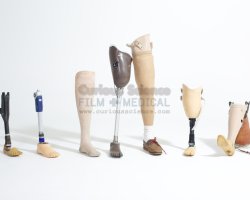 Prosthetics