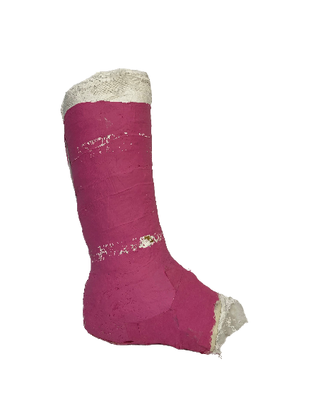 Plaster Half Leg Cast (Pink)