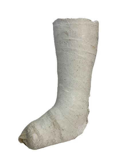 Plaster Half Leg Cast
