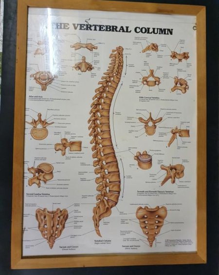 Anatomical Framed Print The Vertebral Column 