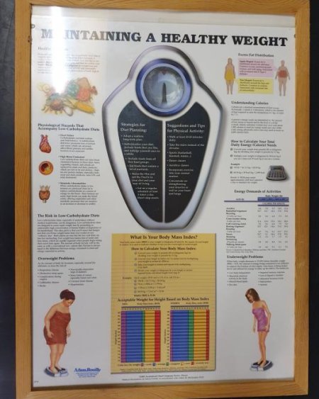 Anatomical Framed Print Maintaining a Healthy Weight