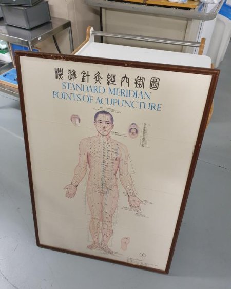 Acupuncture framed poster 
