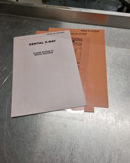 x ray folder