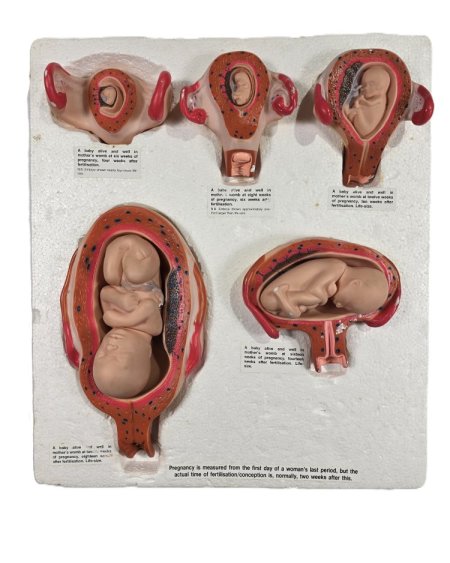 Fetus Development