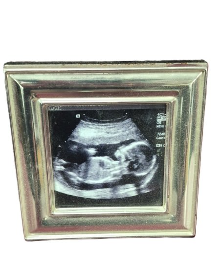Framed Image Of A Fetus