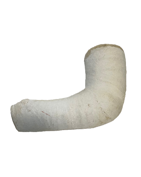 Plaster Arm Cast (Left)