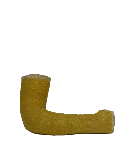 Fibreglass Arm Cast (Right)