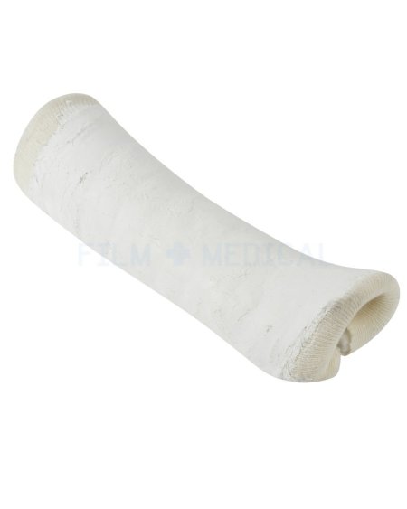 Cast Forearm White Plaster