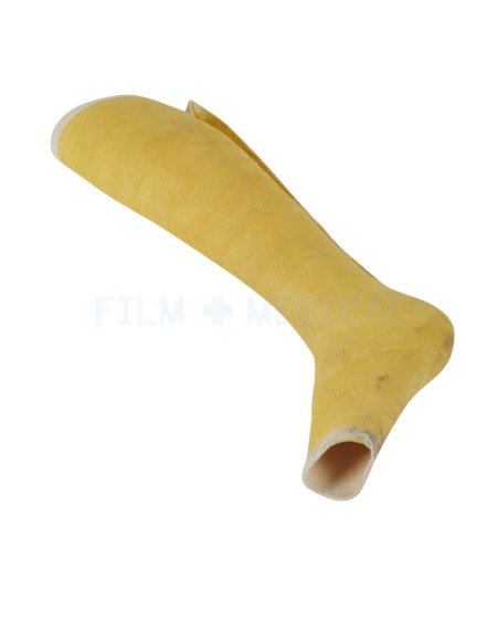 Leg Cast