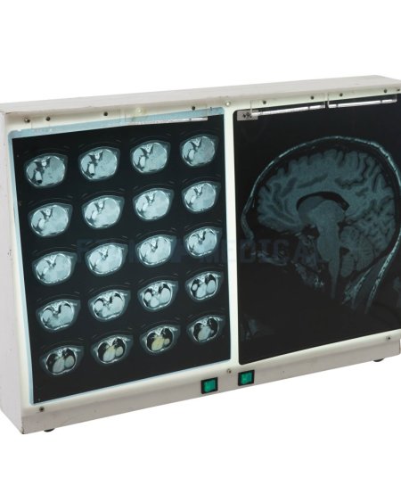 Double Light Box (X-Rays Priced Separately)