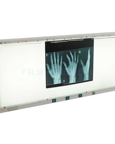 Triple Light Box (X-Rays Priced Separately)