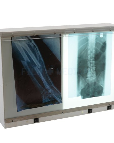Double Light Box (X-Rays Priced Separately)