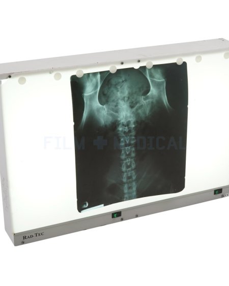 Double Light Box (X-Rays Priced Separately)