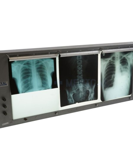 Triple Light Box (X-Rays Priced Separately)