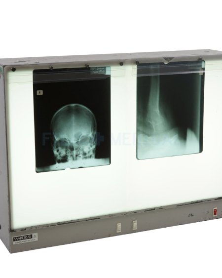 Double Light Box (X-Rays Priced Separately)