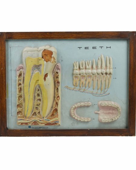Teeth Framed 3D Picture