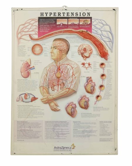 Hypertension Poster 3D