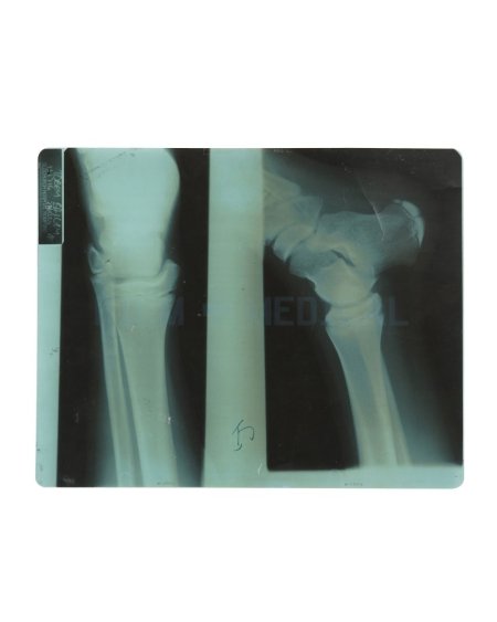 X-Ray Leg