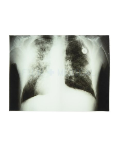 X_Ray_Print_Various