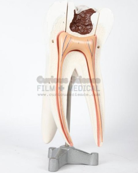 Period Large Molar 