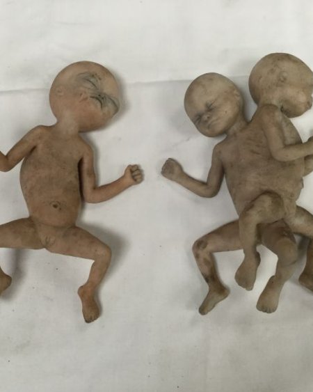 Small deformed babies