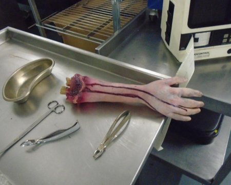 Arm