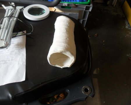 arm cast