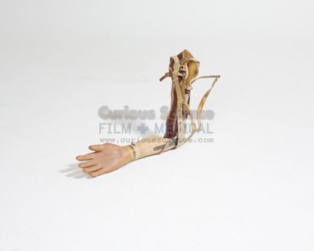 Artificial arm