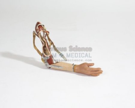 Artificial Arm