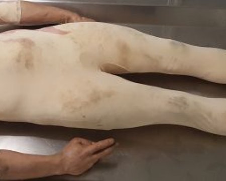 Synthetic Body 