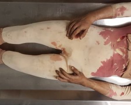 Synthetic Body 