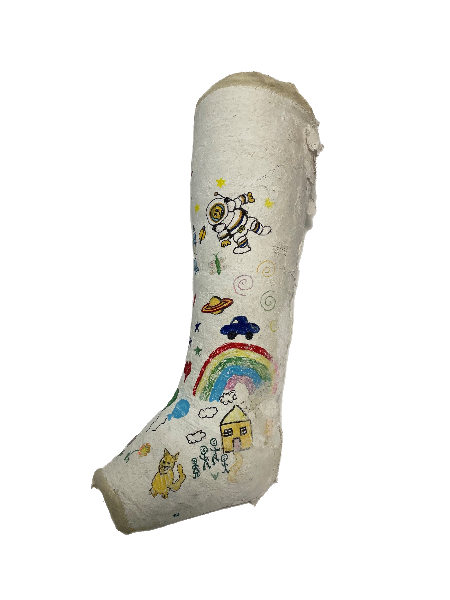 Plaster Half leg cast