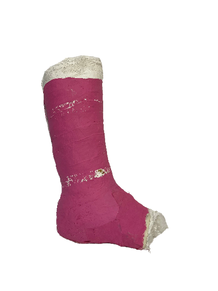 Plaster Half Leg Cast (Pink)