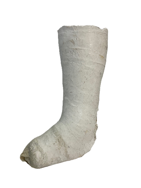 Plaster Half Leg Cast