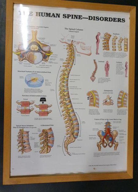 Anatomical Framed Print Human Spine