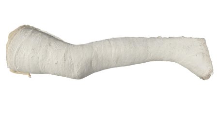 White Full Leg Cast