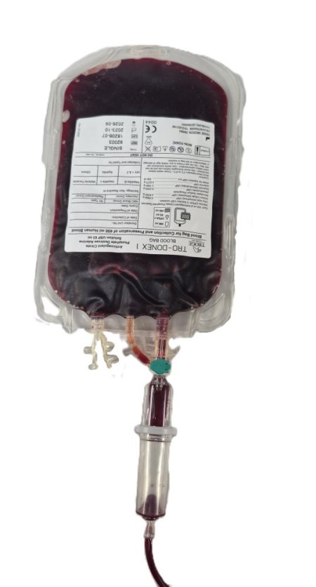 Blood Bag With Giving Set
