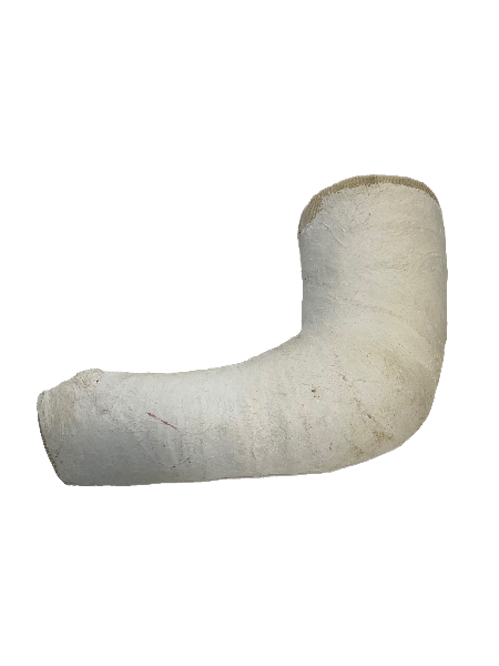 Plaster Arm Cast (Left)