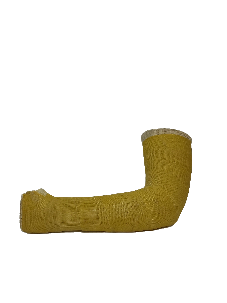Fibreglass Arm Cast (Left)