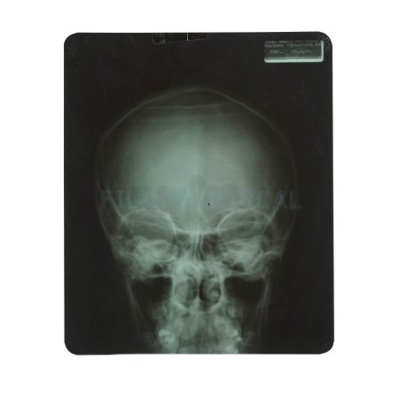 X_Ray Skull