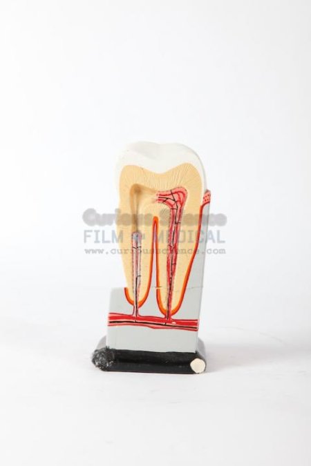 Small Dissected Molar