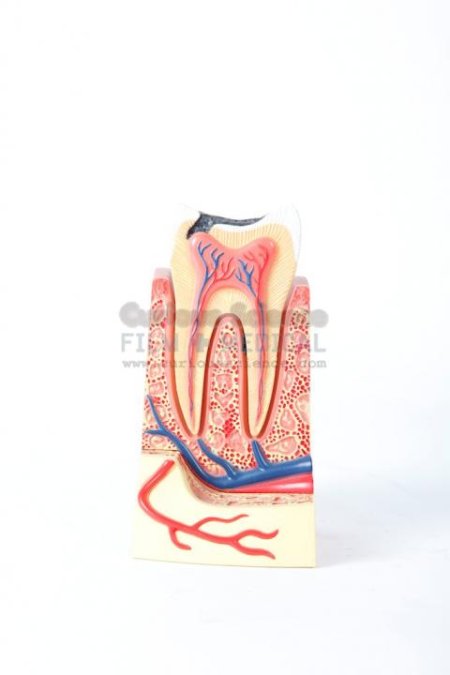 Small Dissected Molar