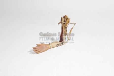 Artificial arm