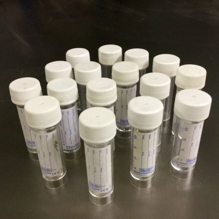 Urine sample containers